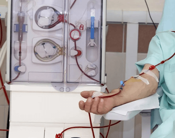 Continuous Peritoneal Dialysis (CPD)