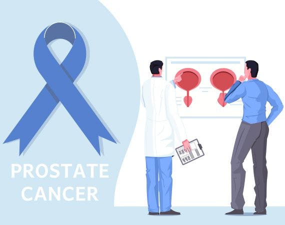 Prostate cancer