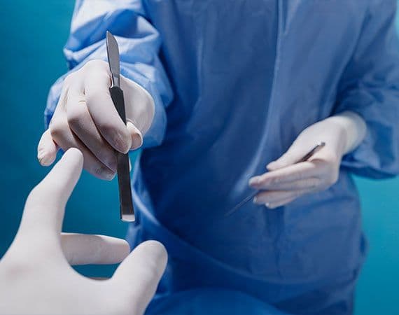 Laparotomy