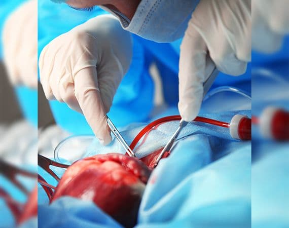 Congenital heart surgery