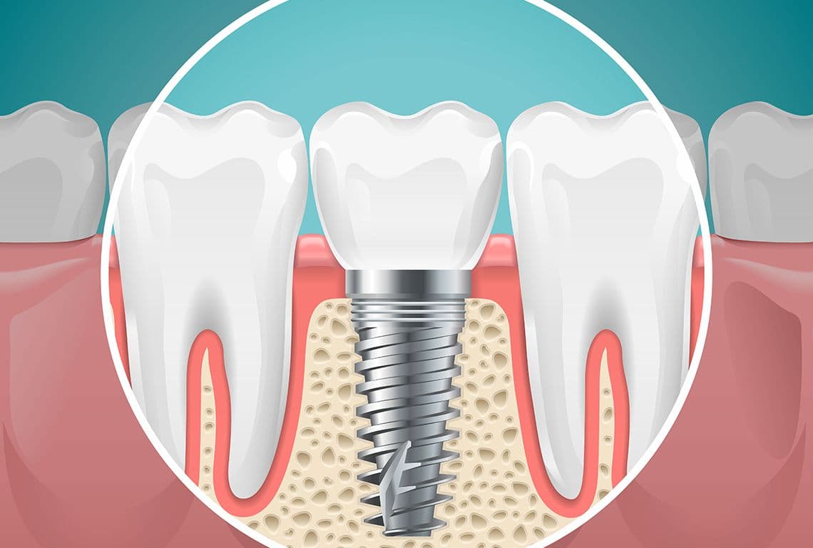 Best Dental Hospital in Jaipur