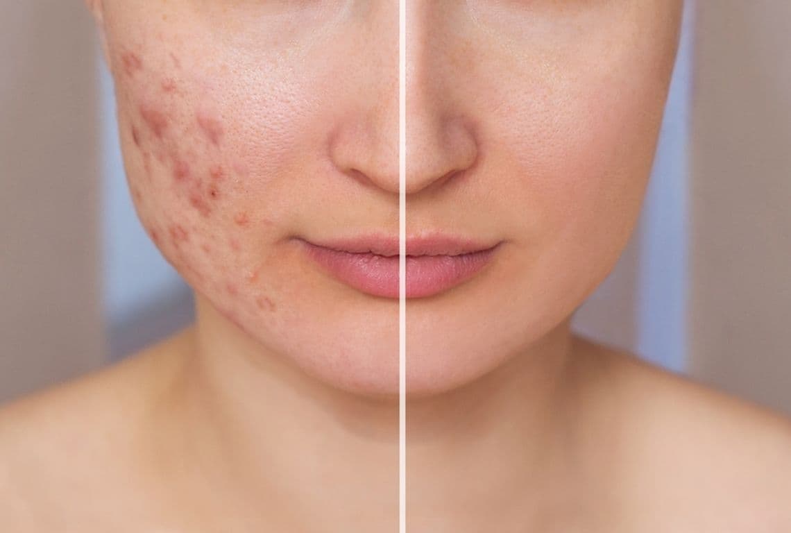 Best Skin Hospital in Jaipur