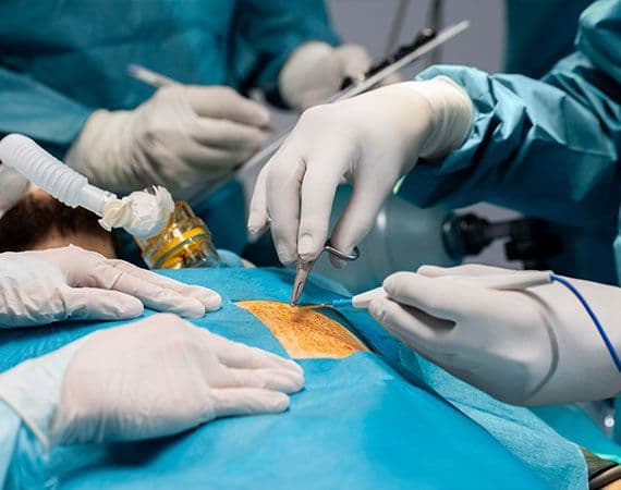 Advanced Hernia Repair