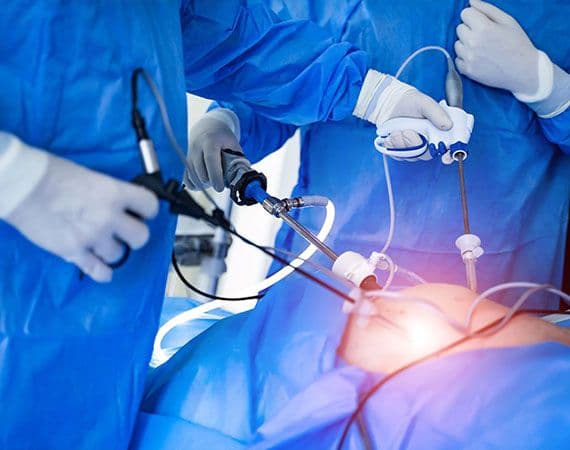 Laparoscopic Surgery