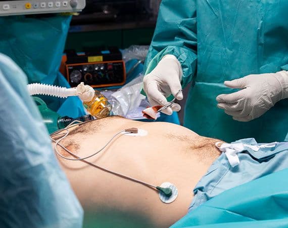 Appendectomy