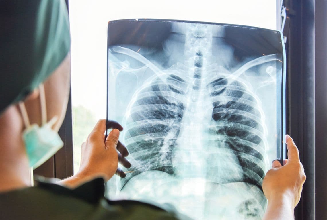 Best Lungs Hospital in Jaipur