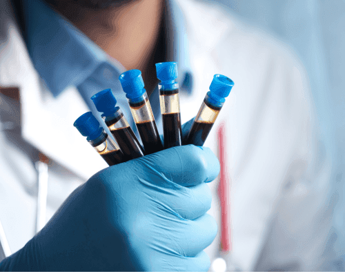 Apex Hospitals Blogs