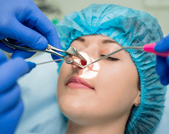 Pilonidal Sinus Surgery