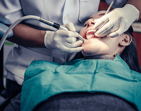 Tonsil Stone Removal