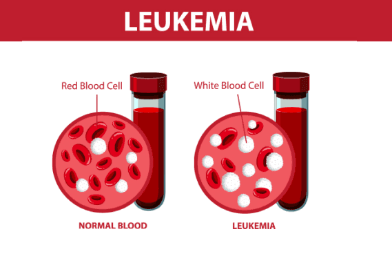 Blood cancer