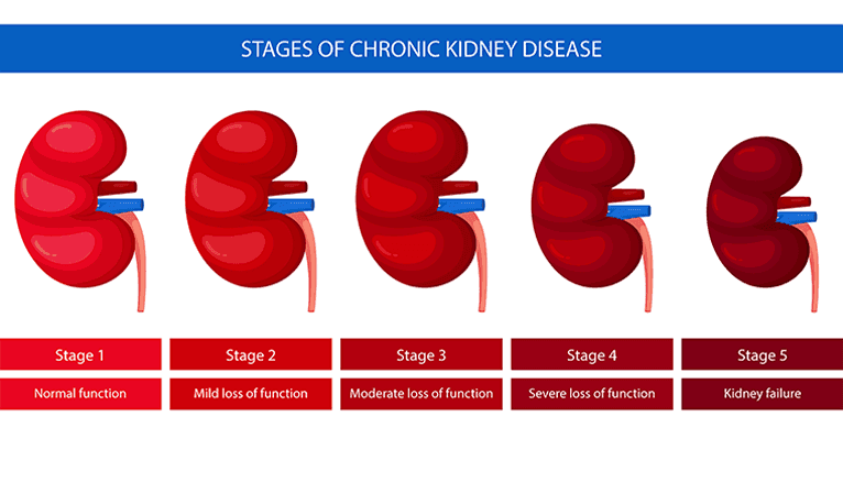 Chronic Kidney Disease