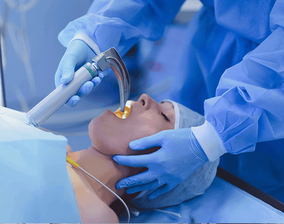 Intubation