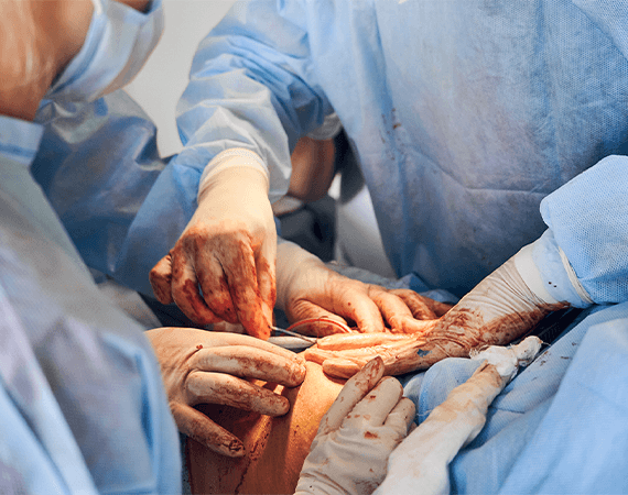 procedure