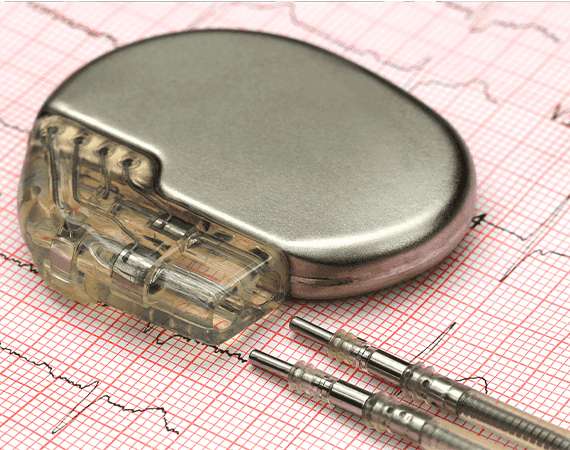 Pacemaker Surgery