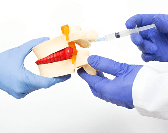 Percutaneous Discectomy/ Nucleoplasty