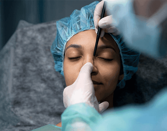 Rhinoplasty