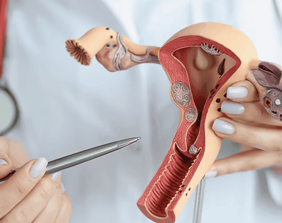 Salpingectomy