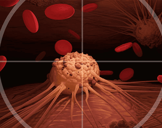 Targeted Therapy