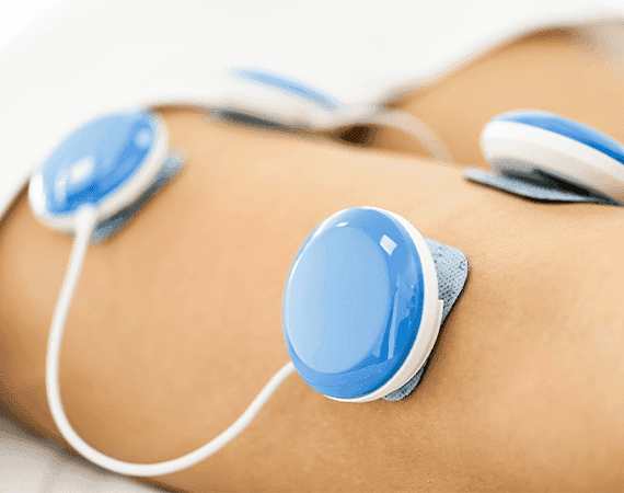Transcutaneous Electrical Nerve Stimulation