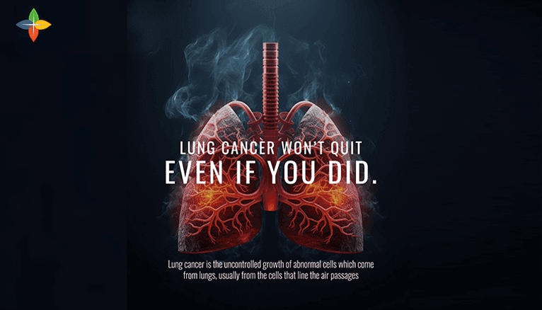 Lung Cancer